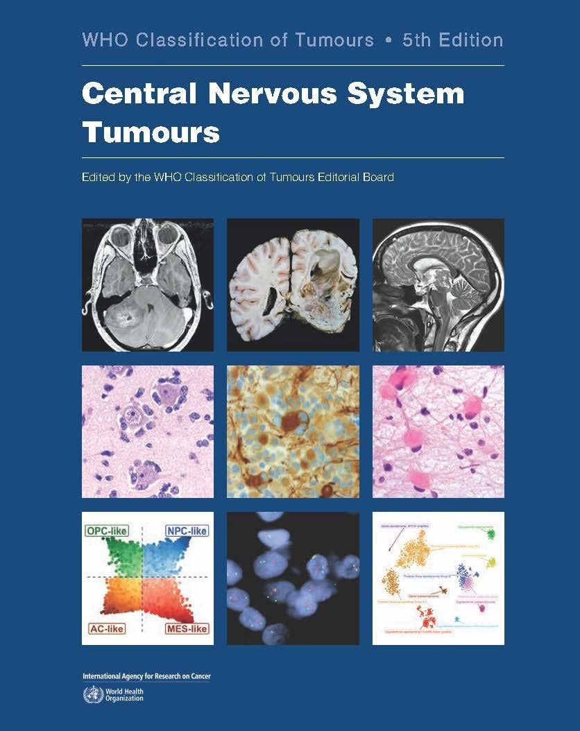 Central Nervous System Tumours PAPERBACK USA STOCK