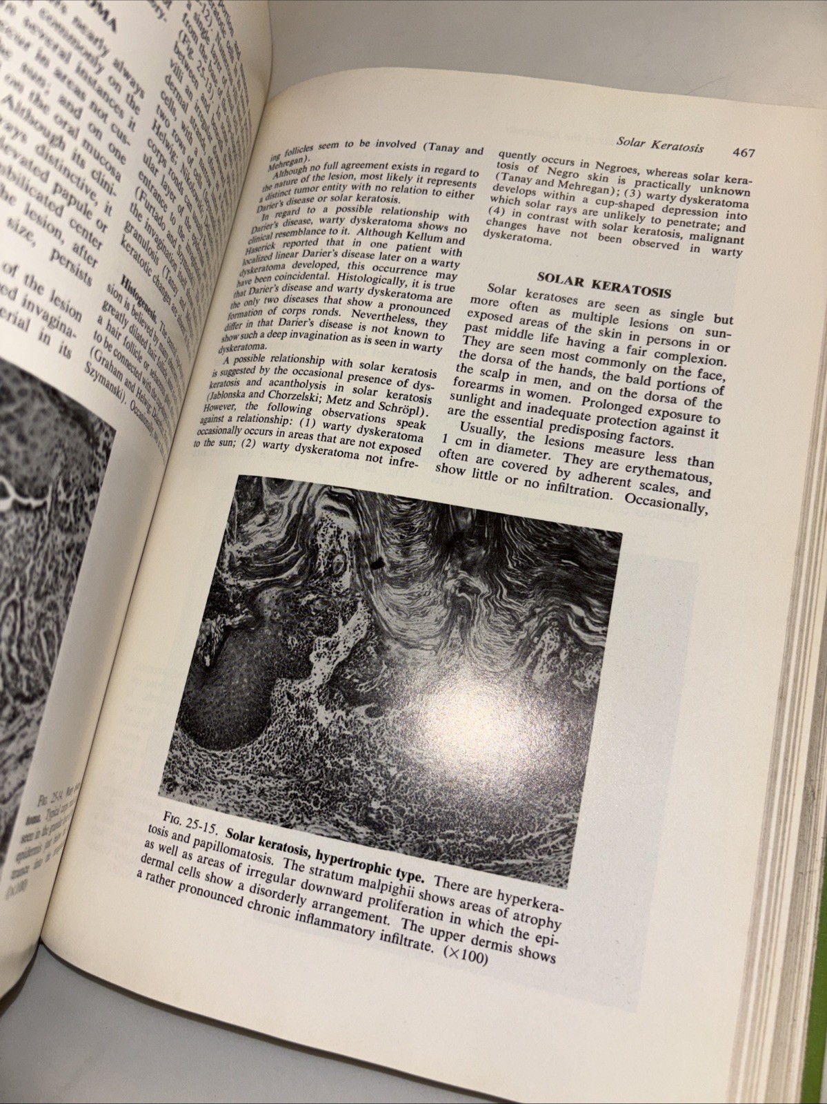 HISTOPATHOLOGY Of The Skin-HC-1975-Walter Lever