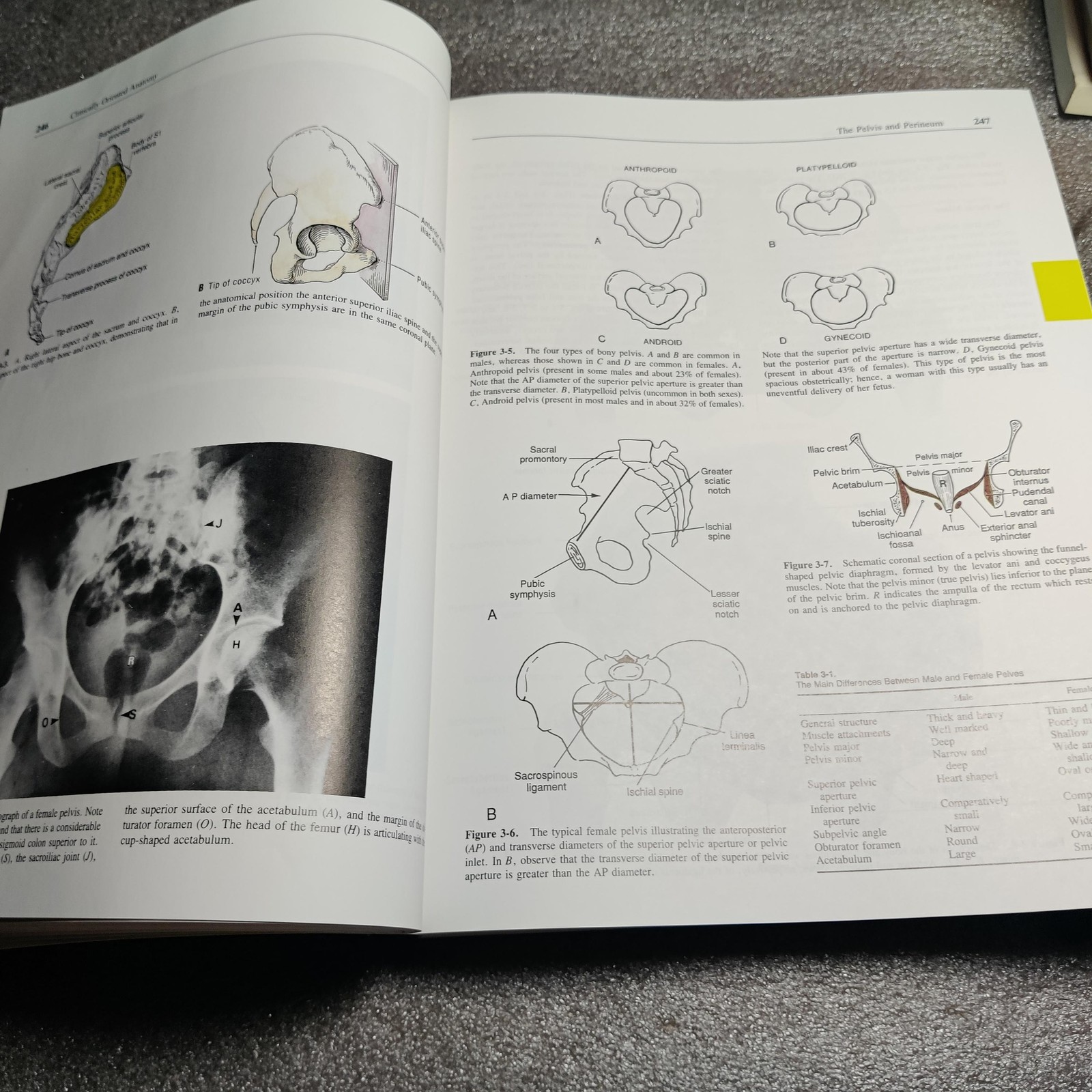 Vintage Clinically Oriented Anatomy Textbook Moore 3rd Ed 1992 Hardcover