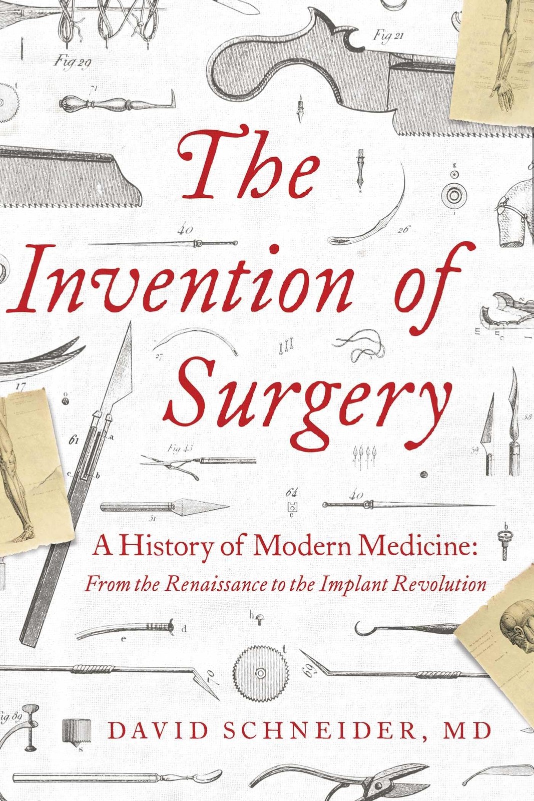 The Invention of Surgery: A History of Modern Medicine: From the Renaissance…
