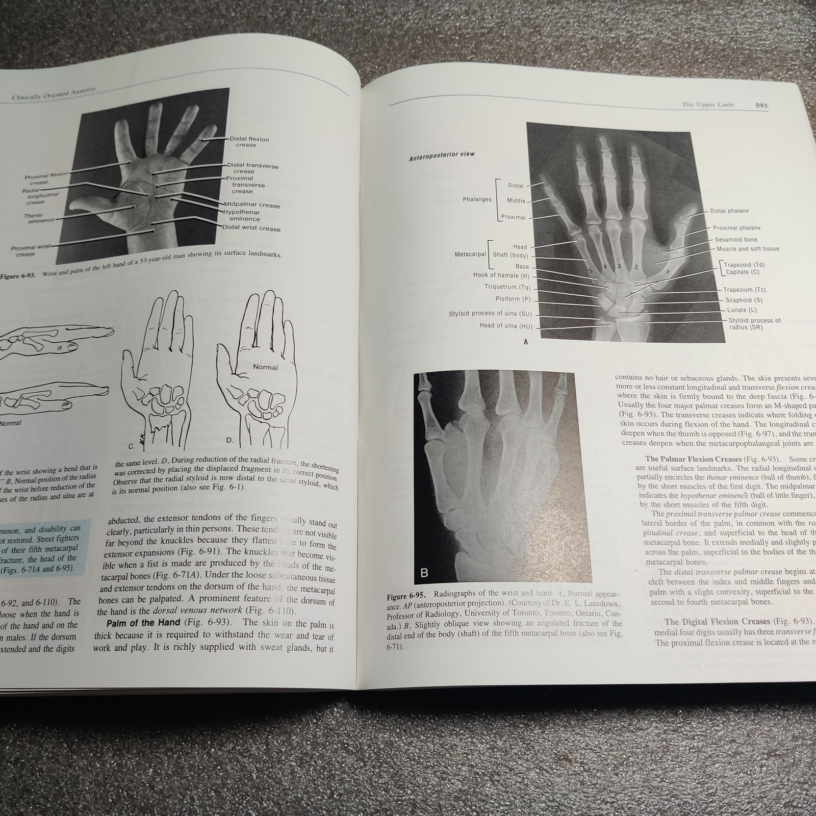 Vintage Clinically Oriented Anatomy Textbook Moore 3rd Ed 1992 Hardcover