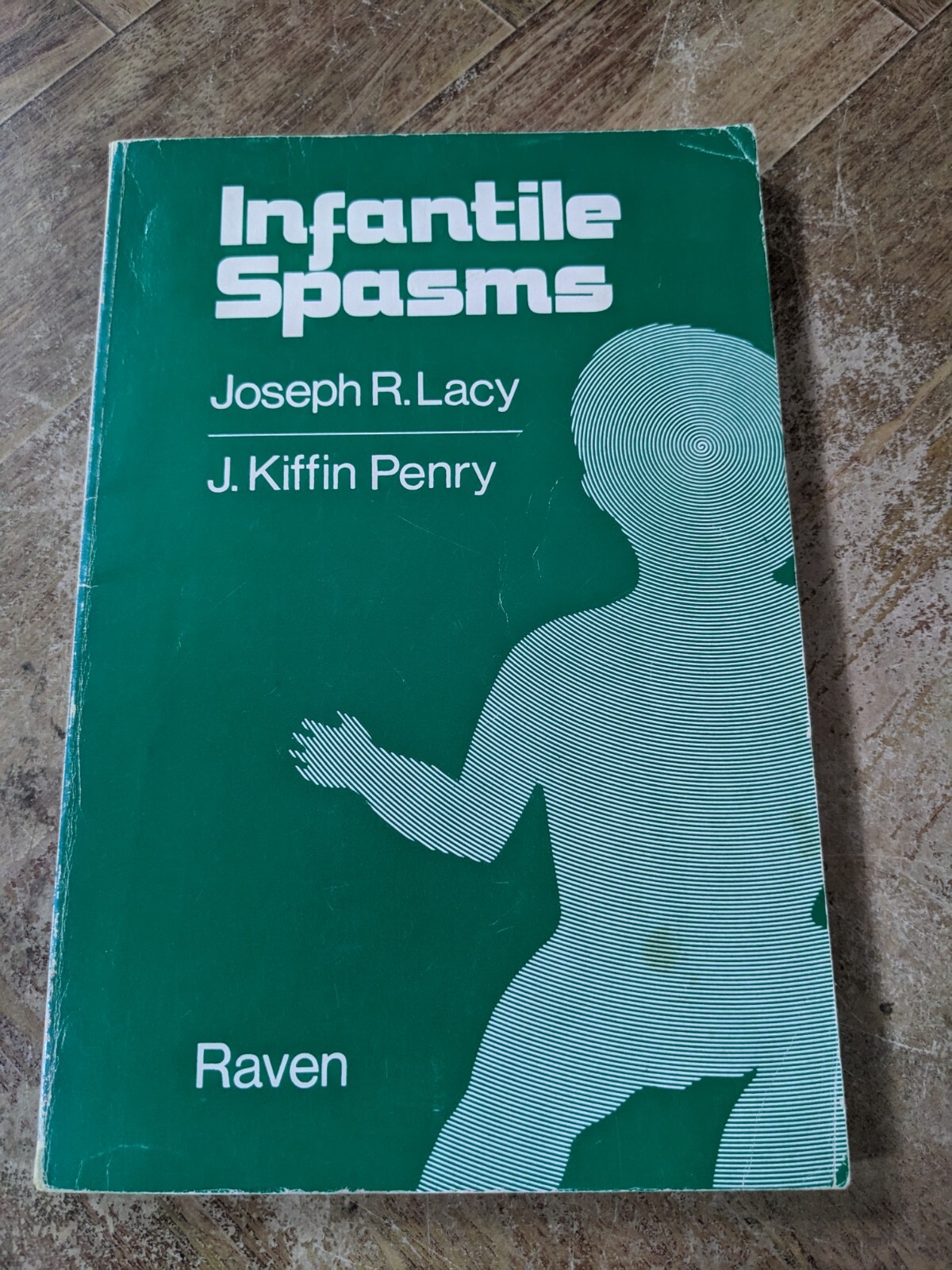 Infantile Spasms: Raven Press Lacy Penry Paperback