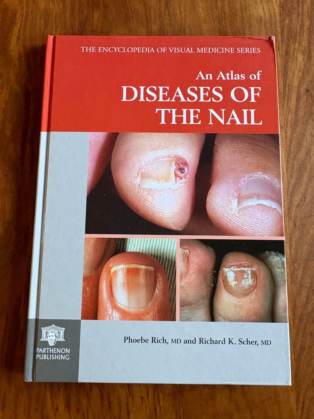 AN ATLAS OF DISEASES OF THE NAIL 2003 HC 1ST/ ENCYCLOPEDIA OF VISUAL MEDICINE