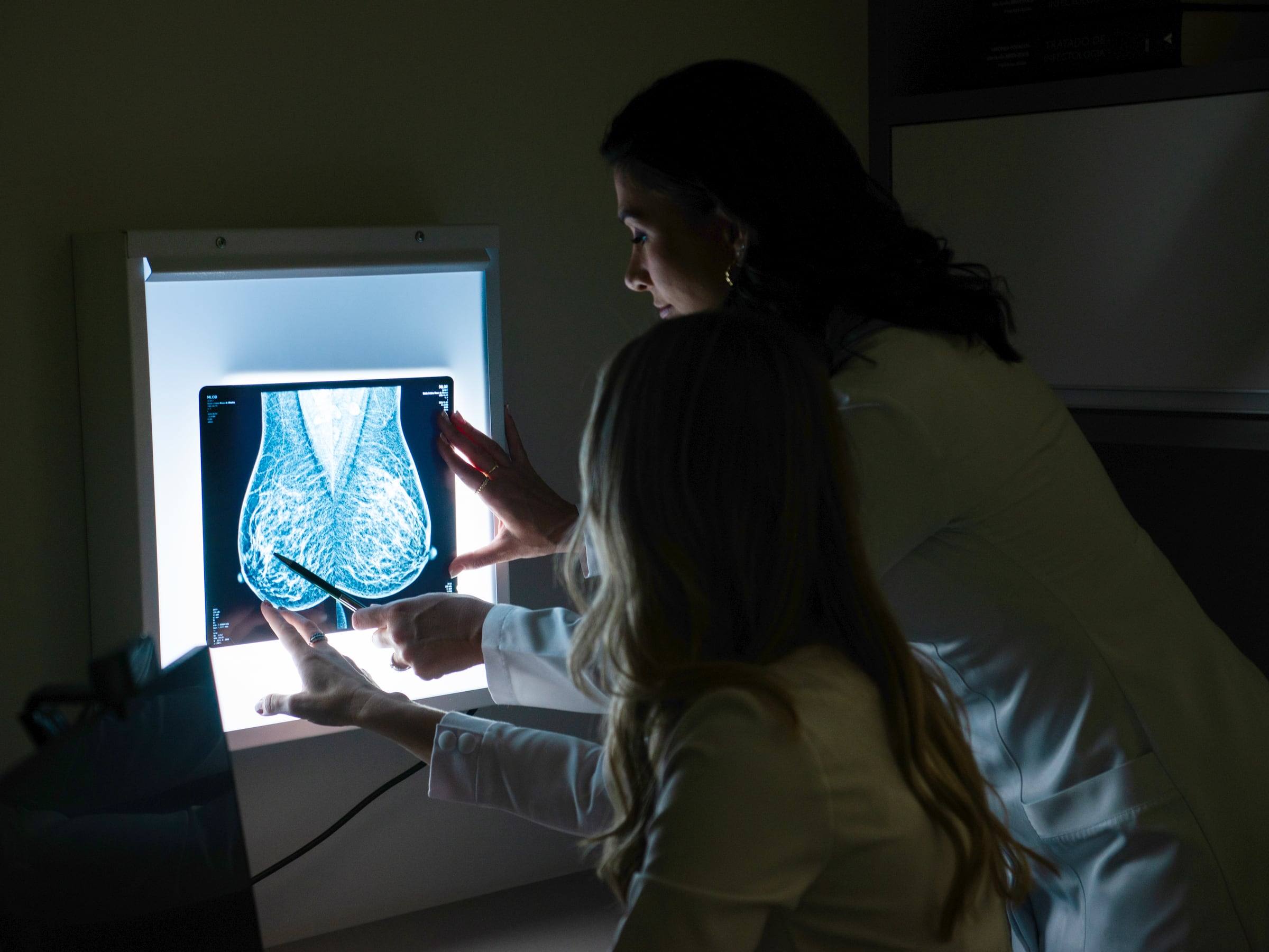 Na penumbra, as médicas radiologistas Dra. Fernanda Falco Sottano Hafner e Dra. Amanda Sanctis Santarém analisam uma mamografia iluminada no negatoscópio.